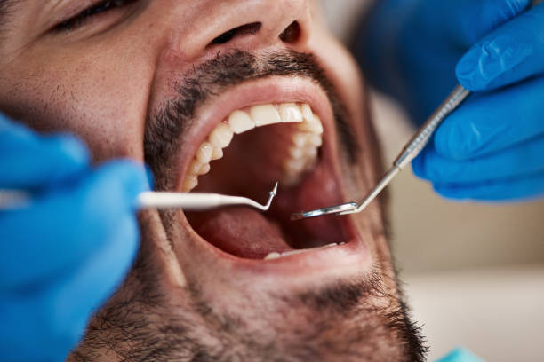Best Emergency Treatment for Toothache in Albany, MO